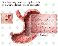 Dysentery