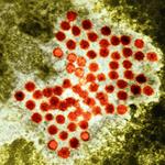 Hepatitis A virus