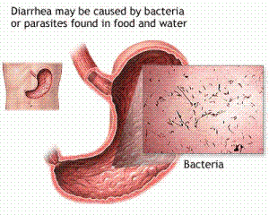 Diarrhea